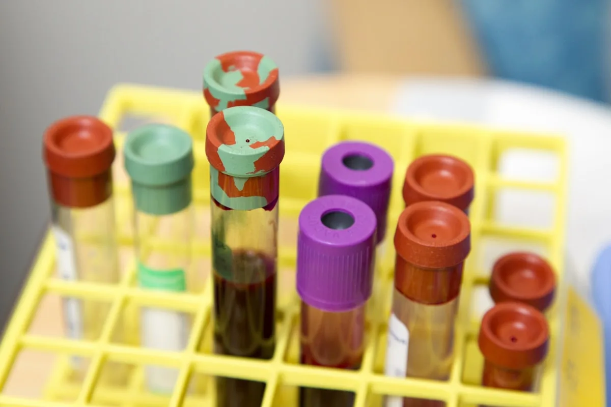 Blood specimens organized in a laboratory rack